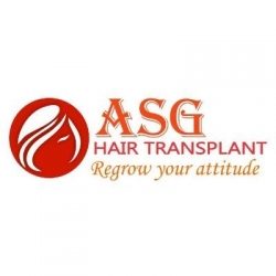 Moustache Hair Transplant in Punjab