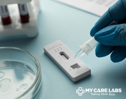 How Covid-19 Test Is Done