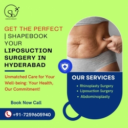 Get The Perfect Shape | Book Your Liposuction Surgery in Hyderabad