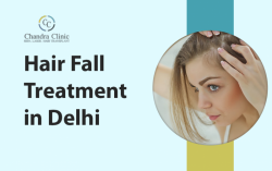 Best Hair Transplant in Delhi