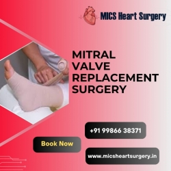 Mitral Valve Replacement Surgery Bangalore | MICS Cost