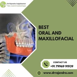 Best Oral & Maxillofacial Surgeon Bangalore | Expert Trauma Care