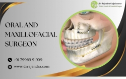 Best Oral & Maxillofacial Surgeon Bangalore | Expert Trauma Care