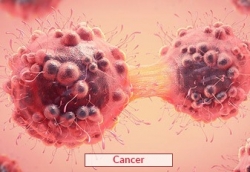 Cancer Treatment in India | Edhacare Medical Tourism Company